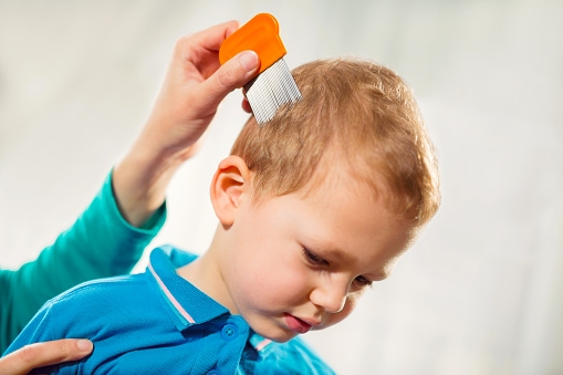 Dealing with nits in small children