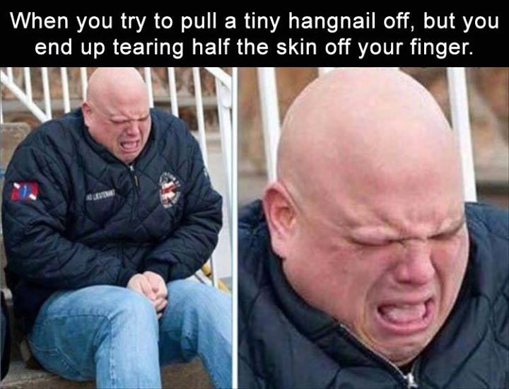 WHEN YOU TRY TO PULL A TINY HANGNAIL OFF, BUT YOU END UP TEA